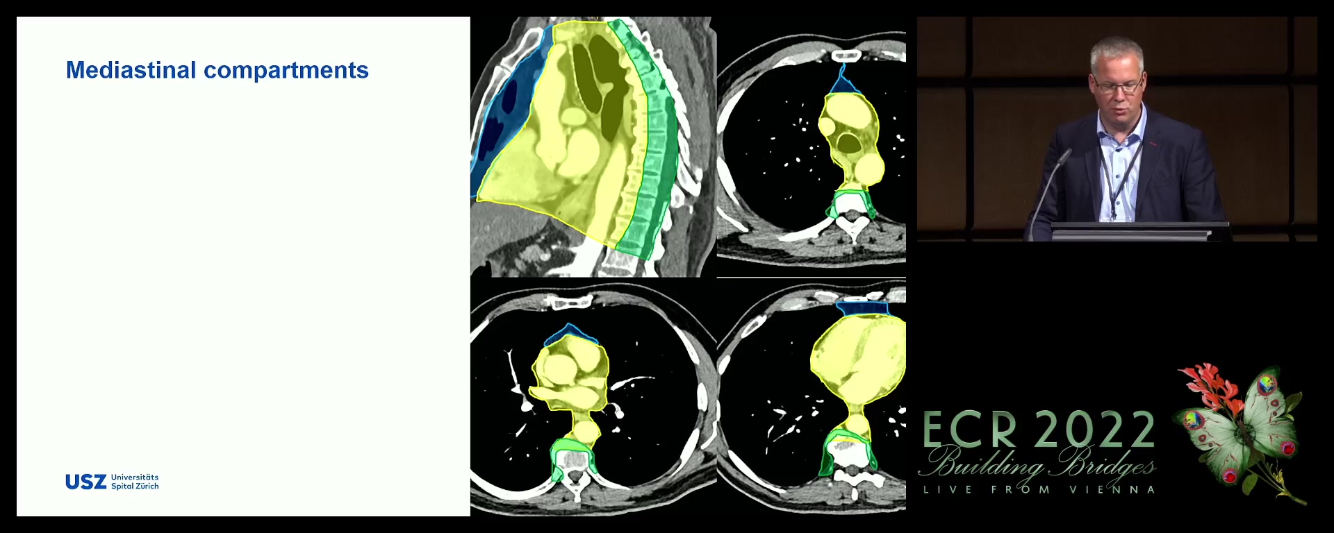 Diagnostic approach using CT and MRI