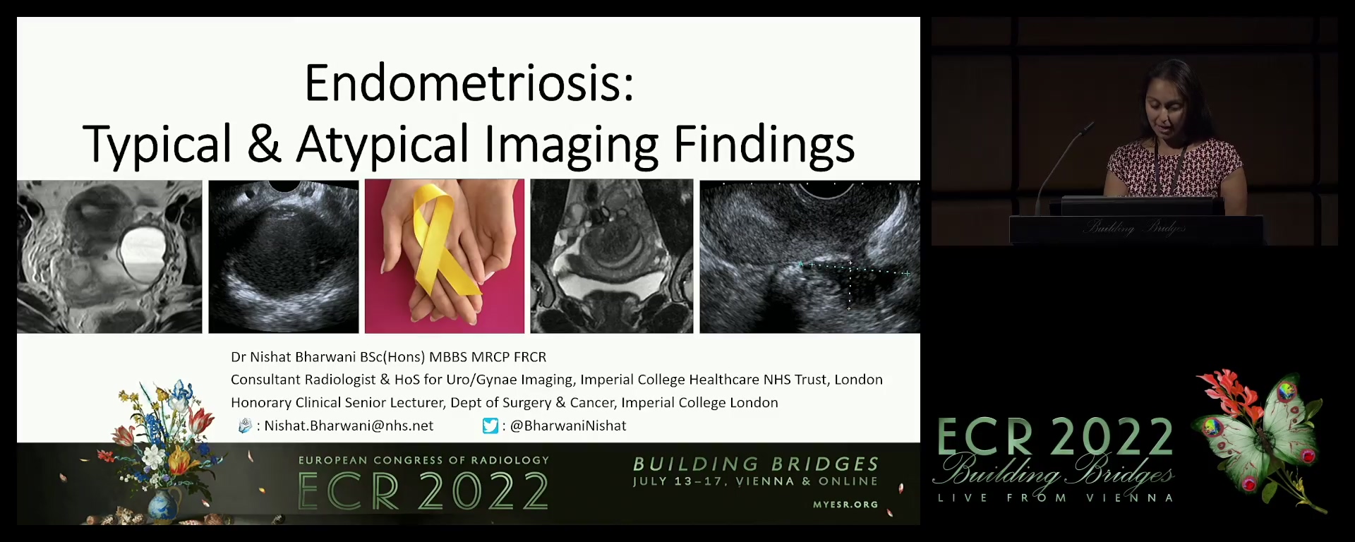 Endometriosis: typical and atypical imaging findings - Nishat Bharwani, London / UK