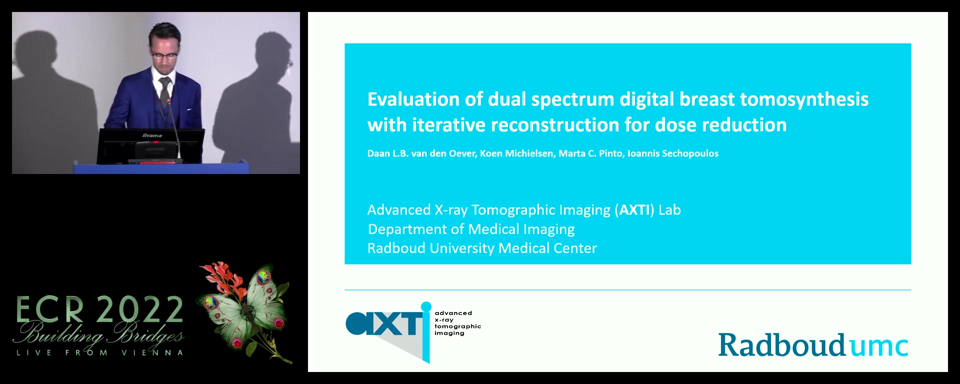 Evaluation of dual spectrum digital breast tomosynthesis with iterative reconstruction for dose reduction