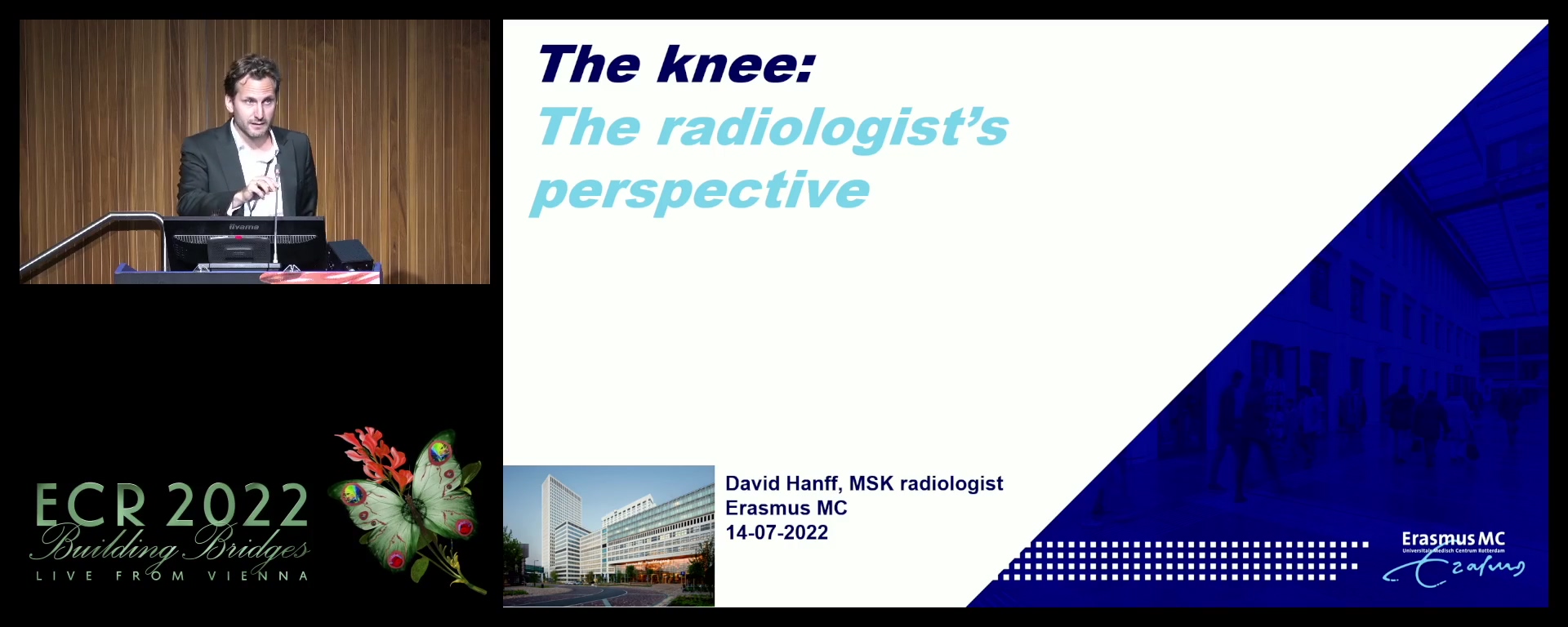 The knee: the radiologist's perspective