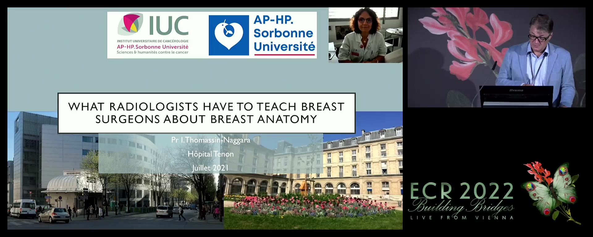 What radiologists have to teach breast surgeons about breast anatomy