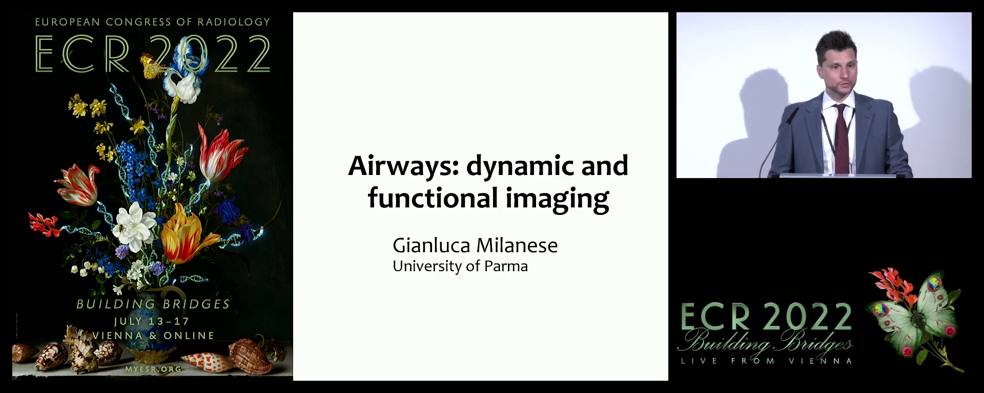 Airways: dynamic and functional imaging