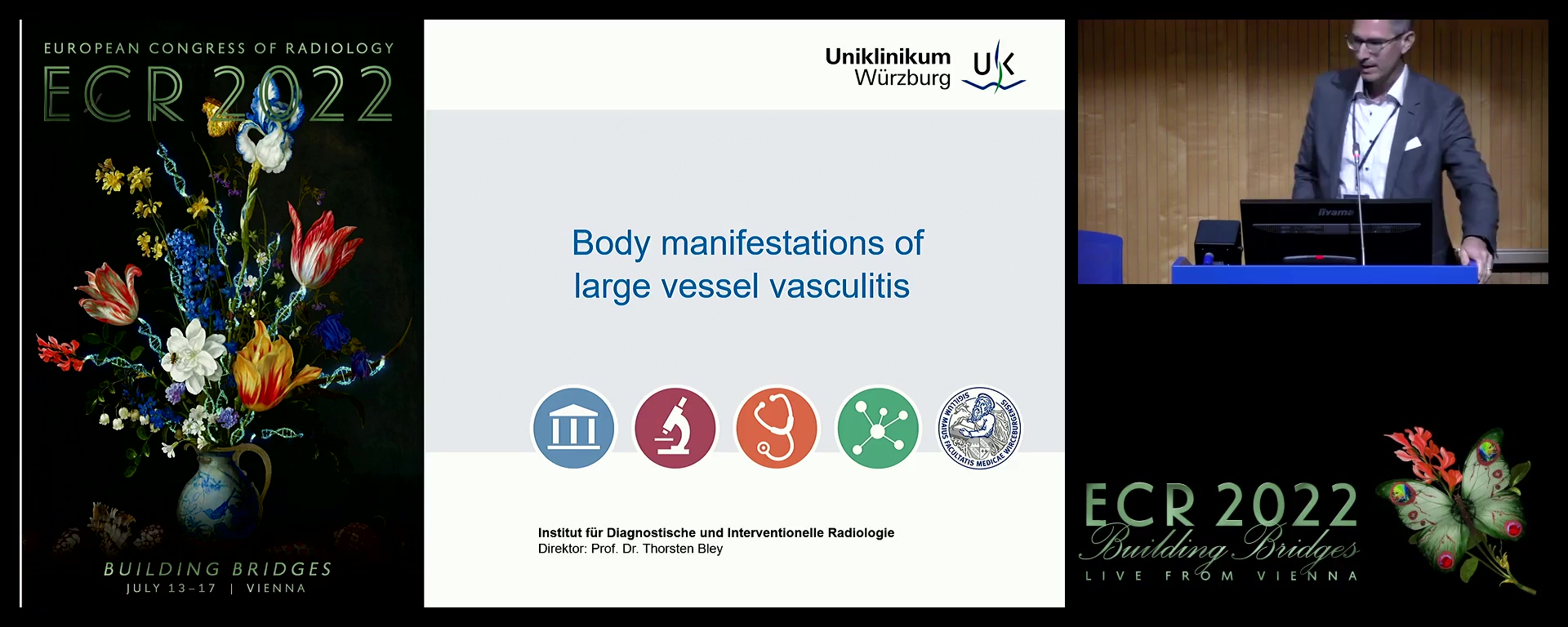 Body manifestations of large vessel vasculitis