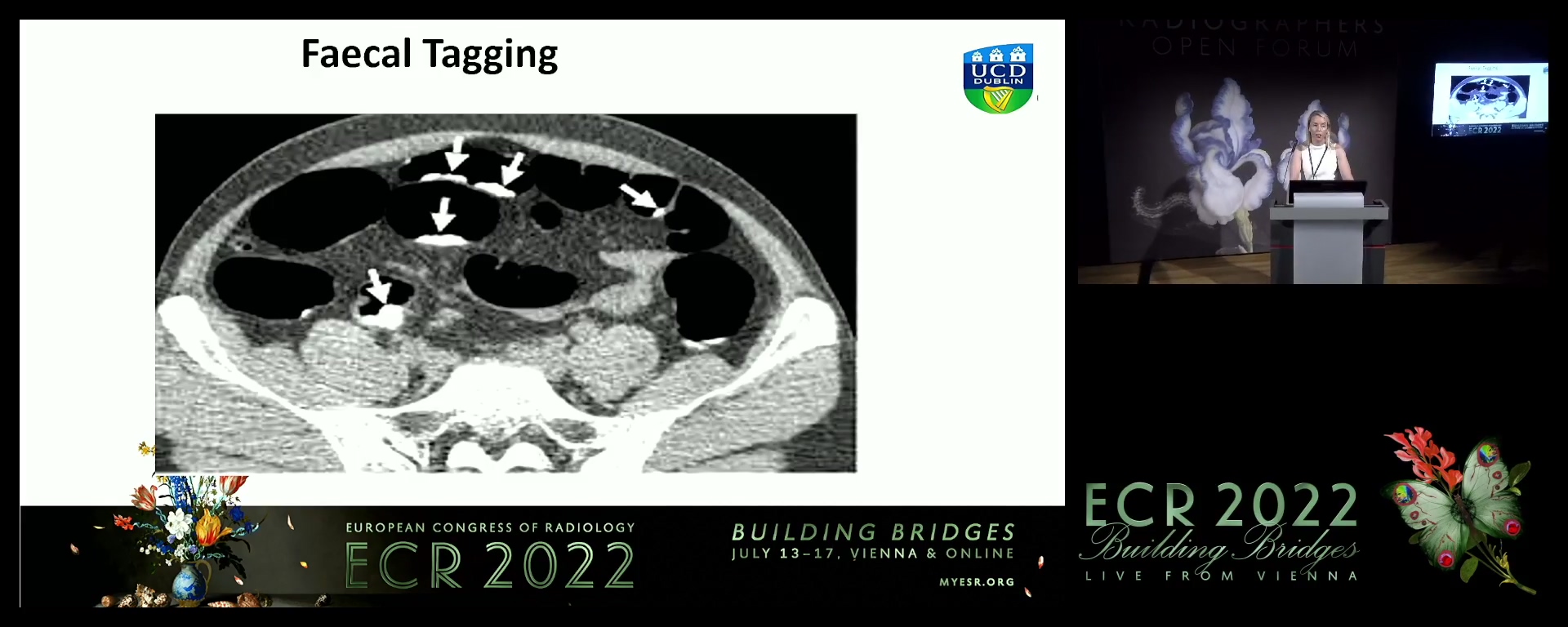 CT gastro-intestinal: presentation radiographer