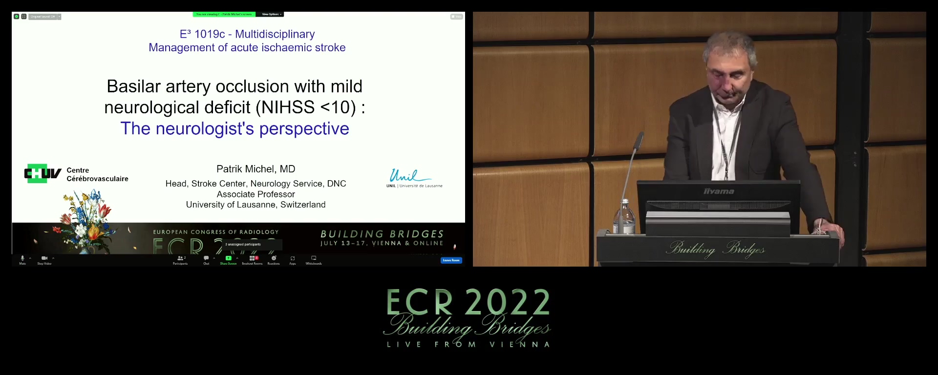 Basilar artery occlusion with mild neurological deficit (NIHSS <10), the neurologist's perspective