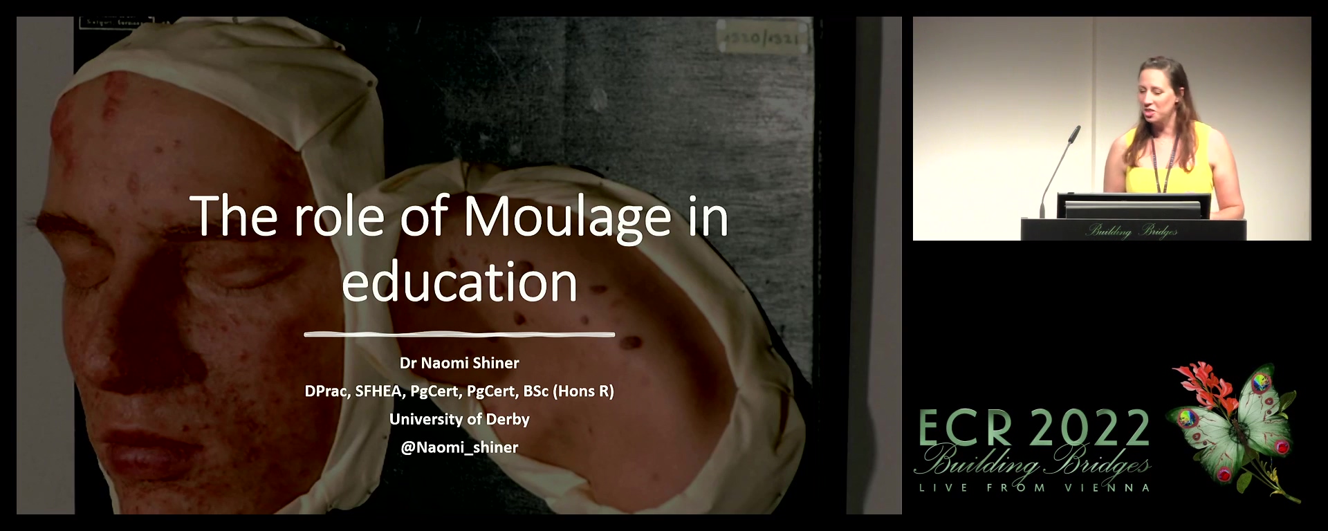 The use of moulage in teaching - Naomi Shiner, Derby / UK