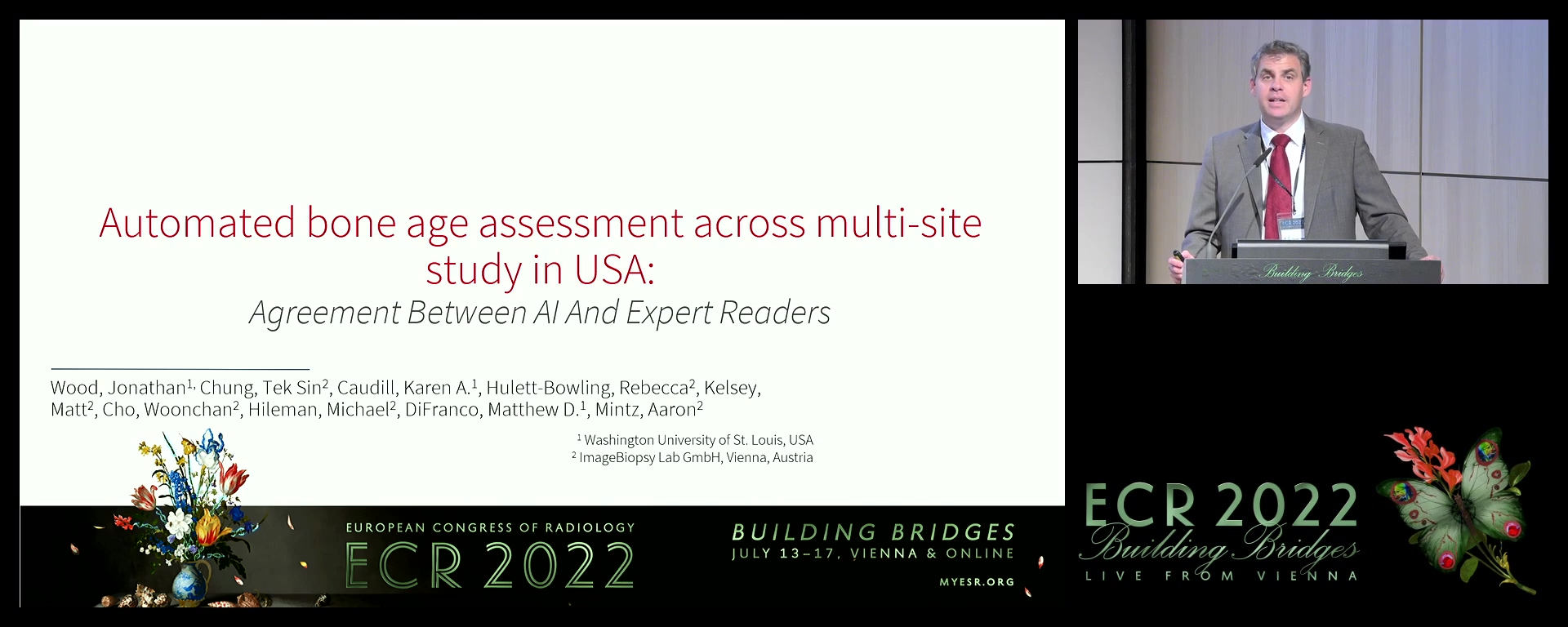 Automated bone age assessment on a multi-site US cohort: agreement between AI and expert readers