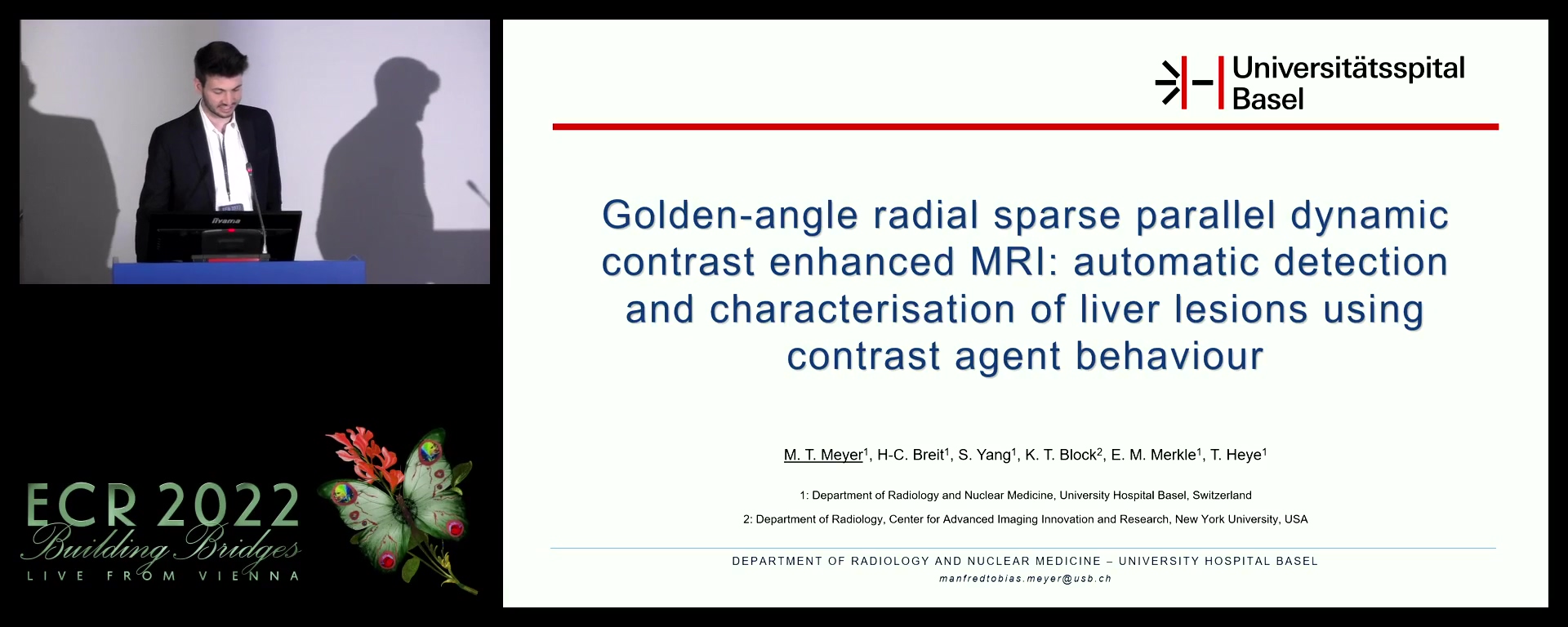 Golden-angle radial sparse parallel dynamic contrast enhanced MRI: automatic detection and characterisation of liver lesions using contrast agent behaviour - Manfred Meyer, Basel / CH
