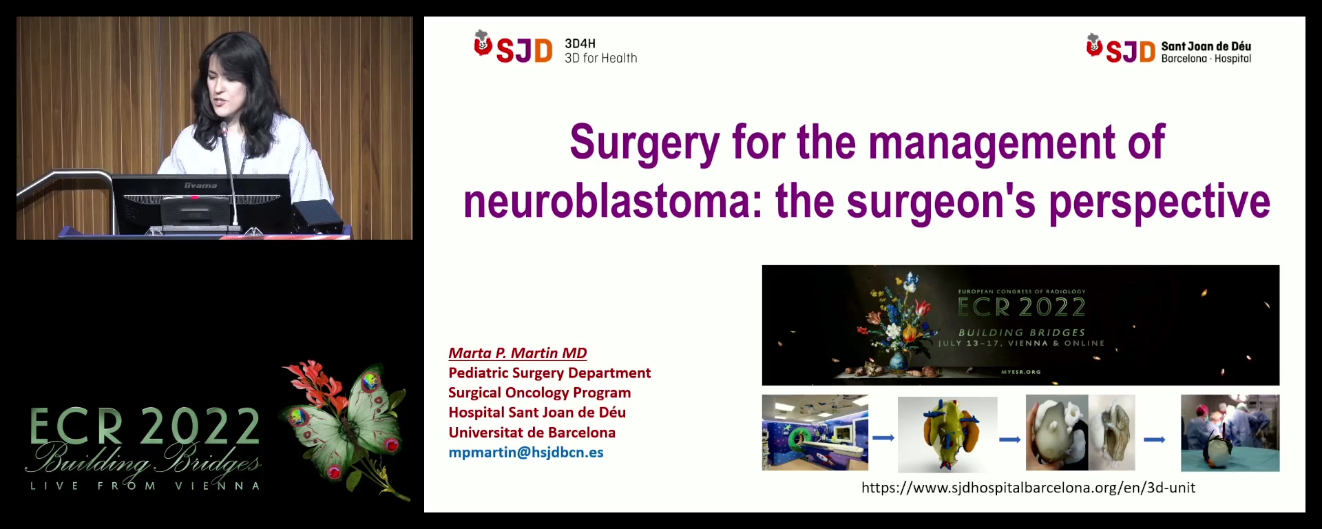 Surgery for the management of neuroblastoma: the surgeon's perspective - Marta P. Martín Giménez, Barcelona / ES