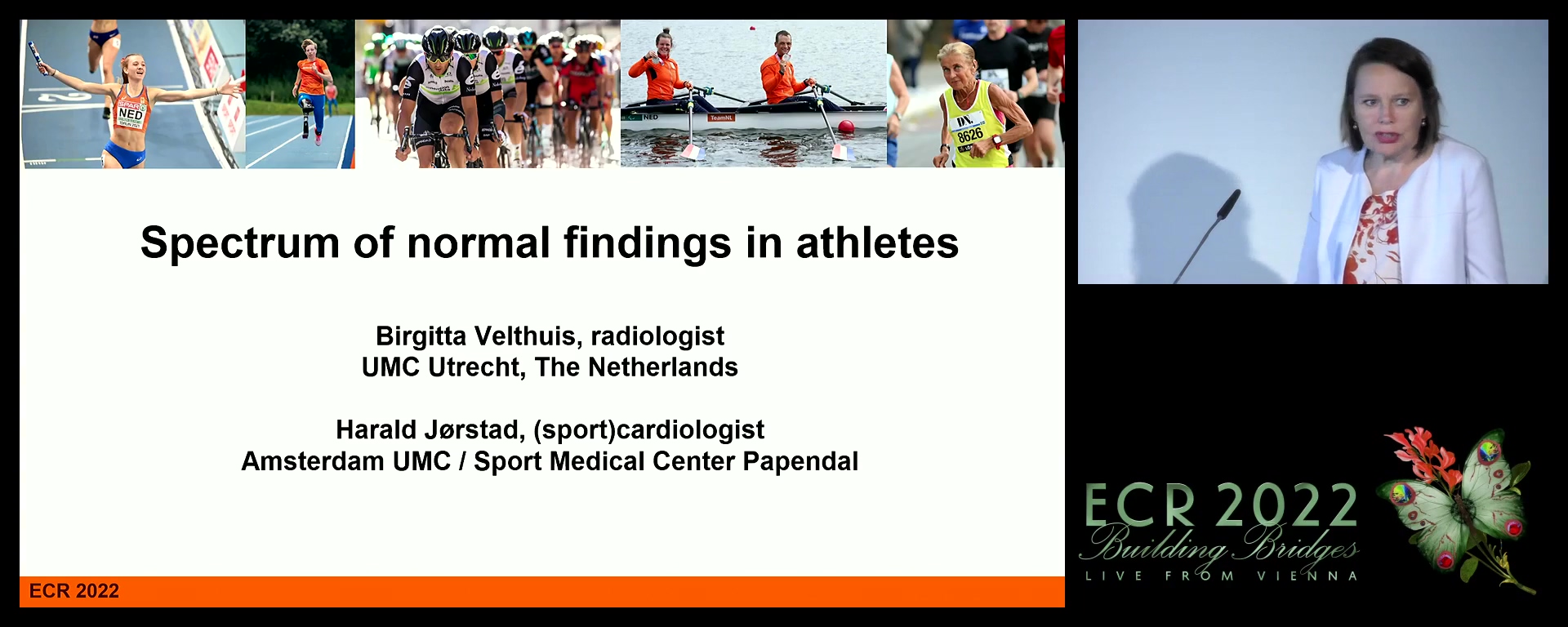 The spectrum of normal cardiac appearances in athletes