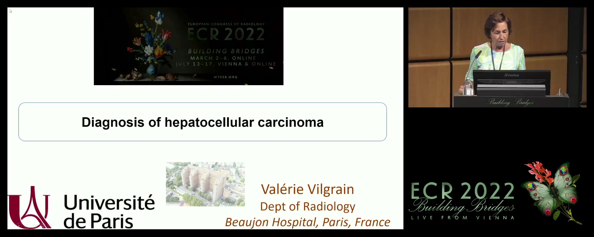 Diagnosis and follow-up of hepatocellular carcinoma