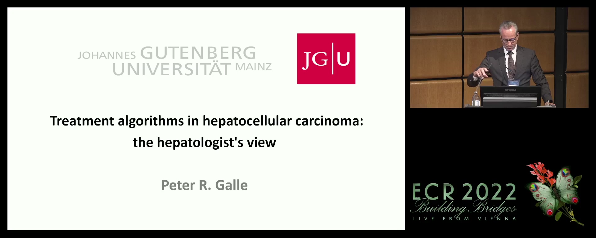 Treatment algorithms in hepatocellular carcinoma: the hepatologist's view
