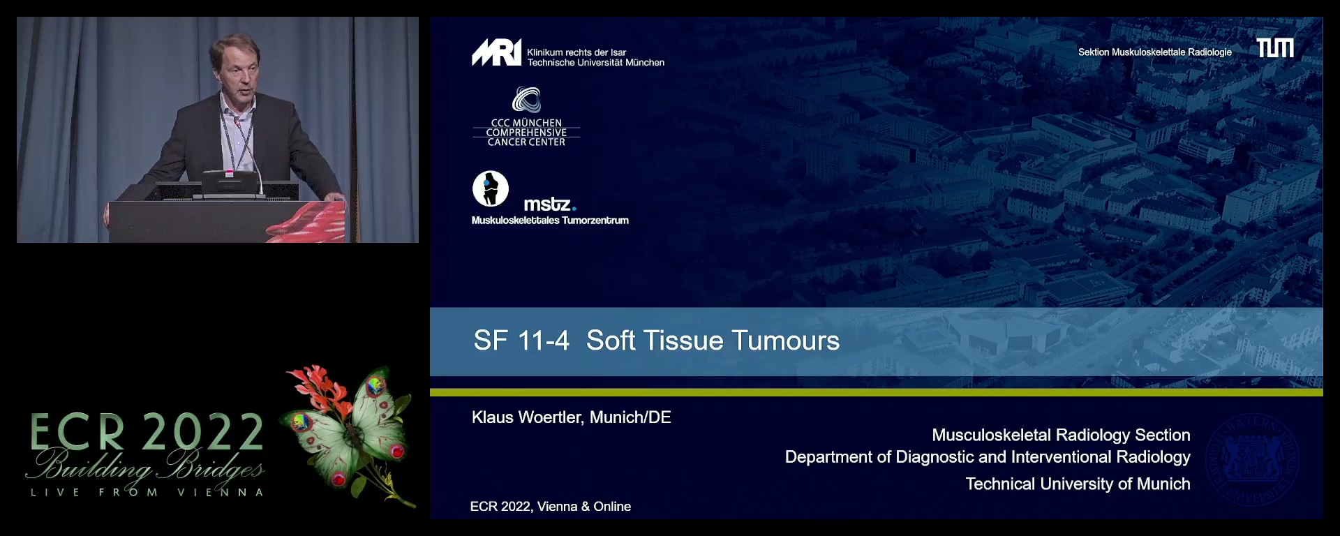 Soft tissue tumours