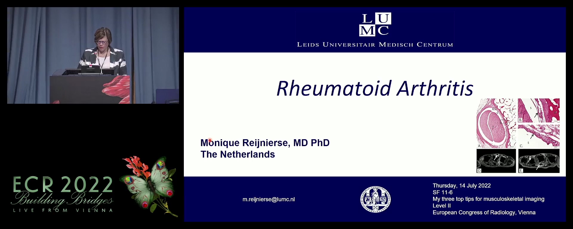 Rheumatoid arthritis - Monique Reijnierse, Leiden / NL