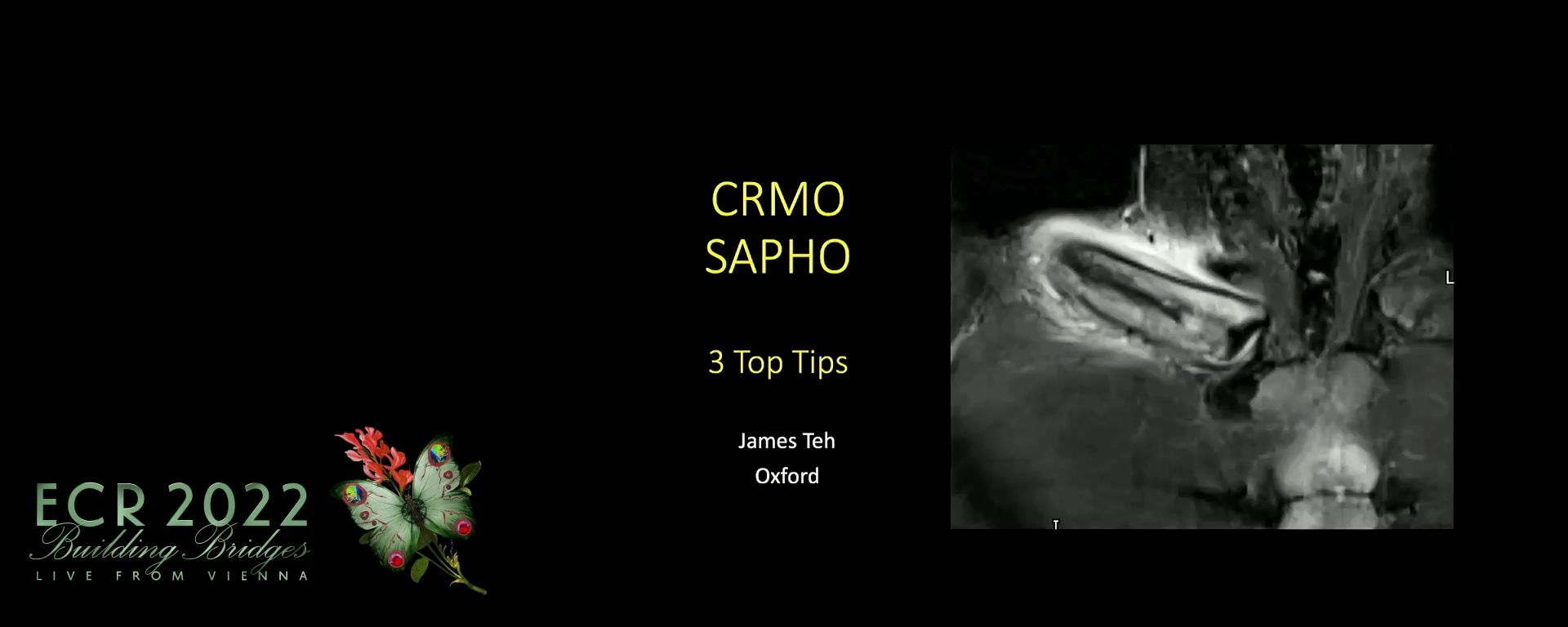 CRMO/CNO/SAPHO - James Teh, Oxford / UK