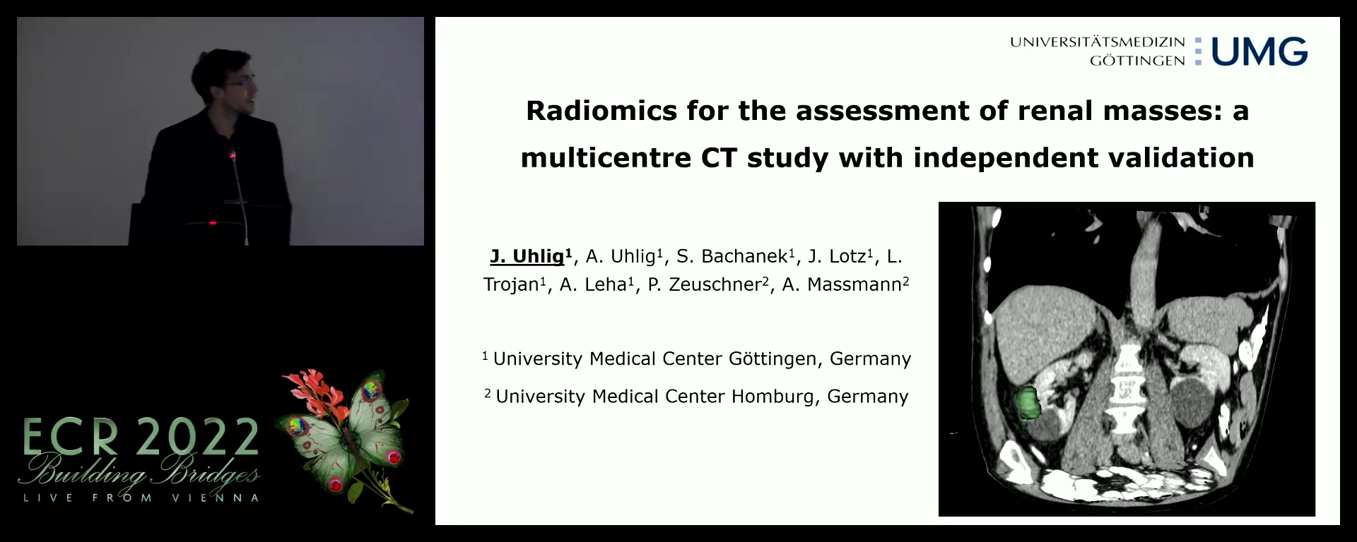 Radiomics for the assessment of renal masses: a multicentre CT study with independent validation