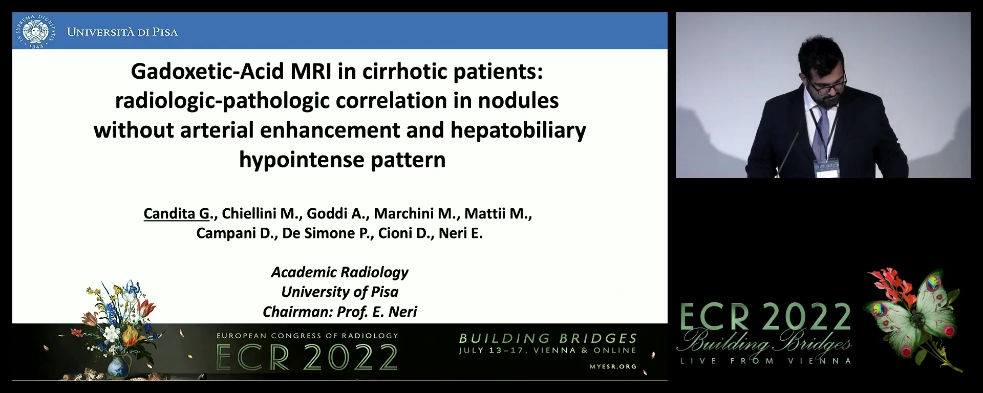 Gadoxetic acid MRI in cirrhotic patients: radiologic-pathologic correlation in nodules without arterial enhancement and hepatobiliary hypointense pattern - Gianvito Candita, Pisa / IT
