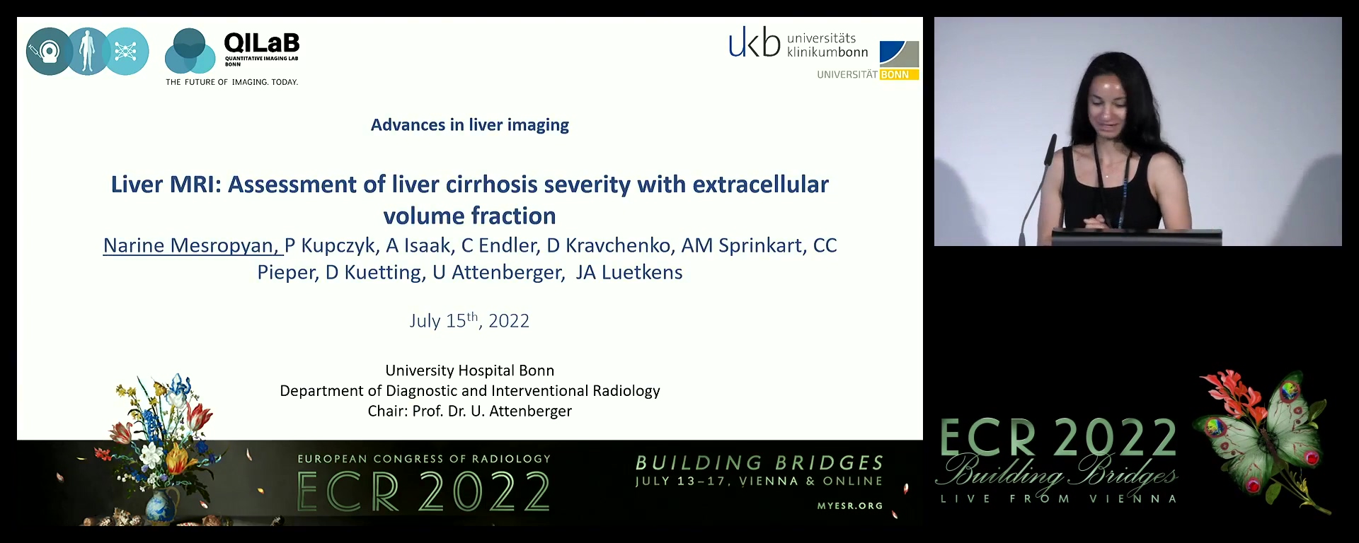 Liver MRI: assessment of liver cirrhosis severity with extracellular volume fraction - Narine Mesropyan, Bonn / DE