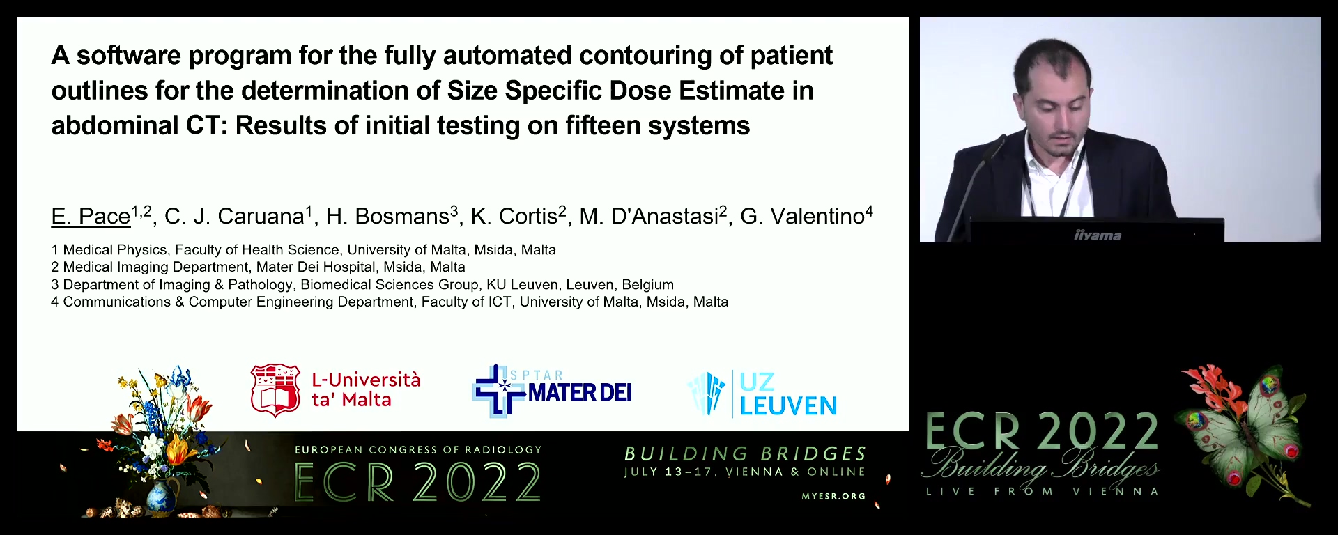A software program for the fully automated contouring of patient outlines for the determination of size specific dose estimate in abdominal CT: results of initial testing on 17 systems - Eric Pace, Msida / MT