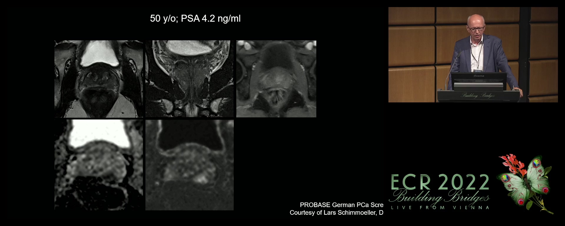 Multidisciplinary tumour board: case-based panel discussion and take home messages