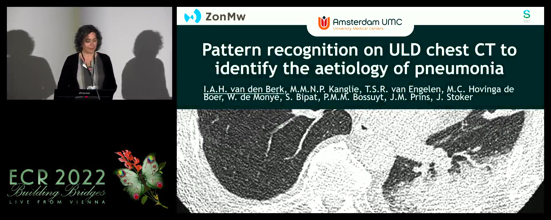 Pattern recognition on ultra-low-dose CT to identify the aetiology of pneumonia - Inge Van Den Berk, Amsterdam / NL