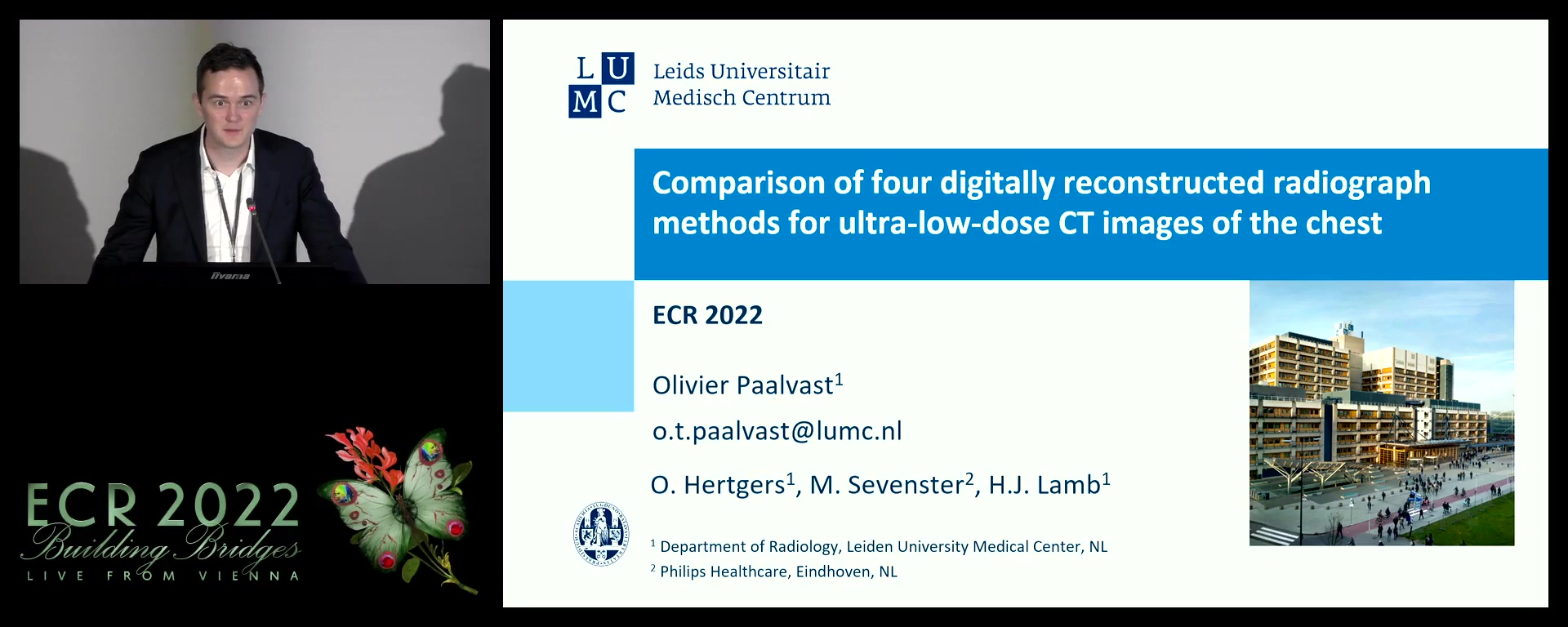 Comparison of three digitally reconstructed radiograph models for ultra-low-dose CT images of the chest - Olivier Paalvast, Amsterdam / NL
