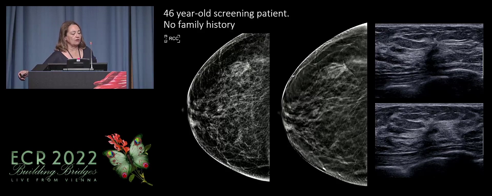 Multidisciplinary tumour board: case-based panel discussions