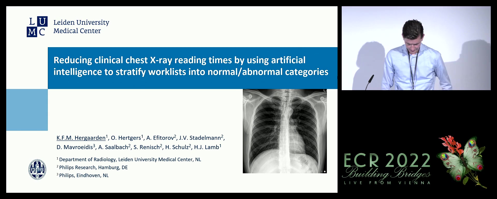 Reducing clinical chest X-ray reading times by using artificial intelligence to stratify worklists into normal/abnormal categories