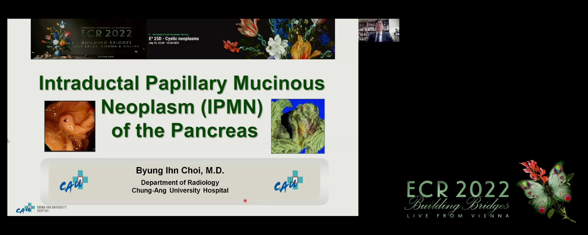 Intraductal papillary neoplasms - Byung Ihn Choi, Seoul / KR