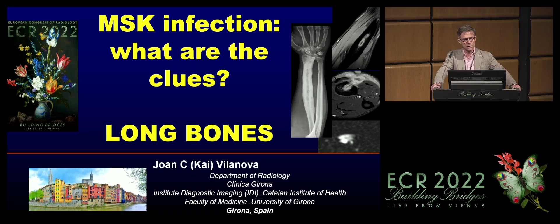Long bones - Joan C. Vilanova, Girona / ES