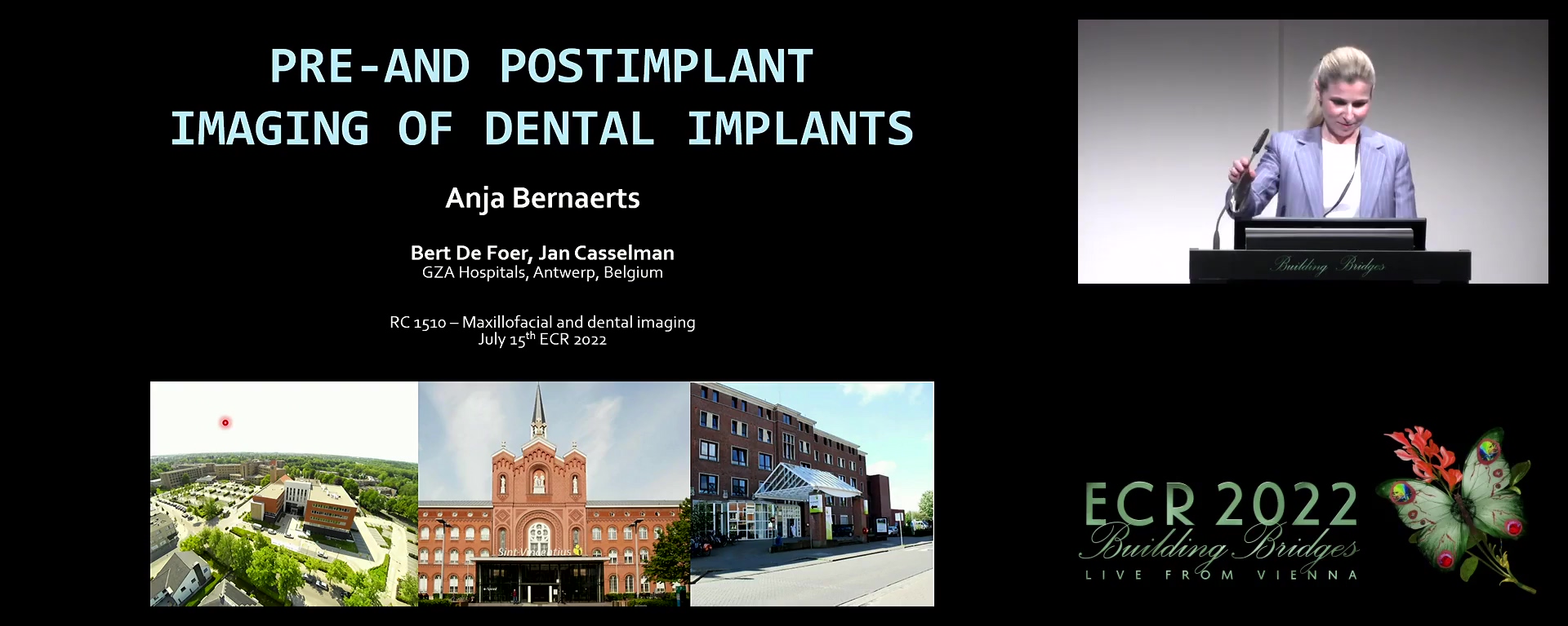 Pre-and postimplant imaging of dental implants