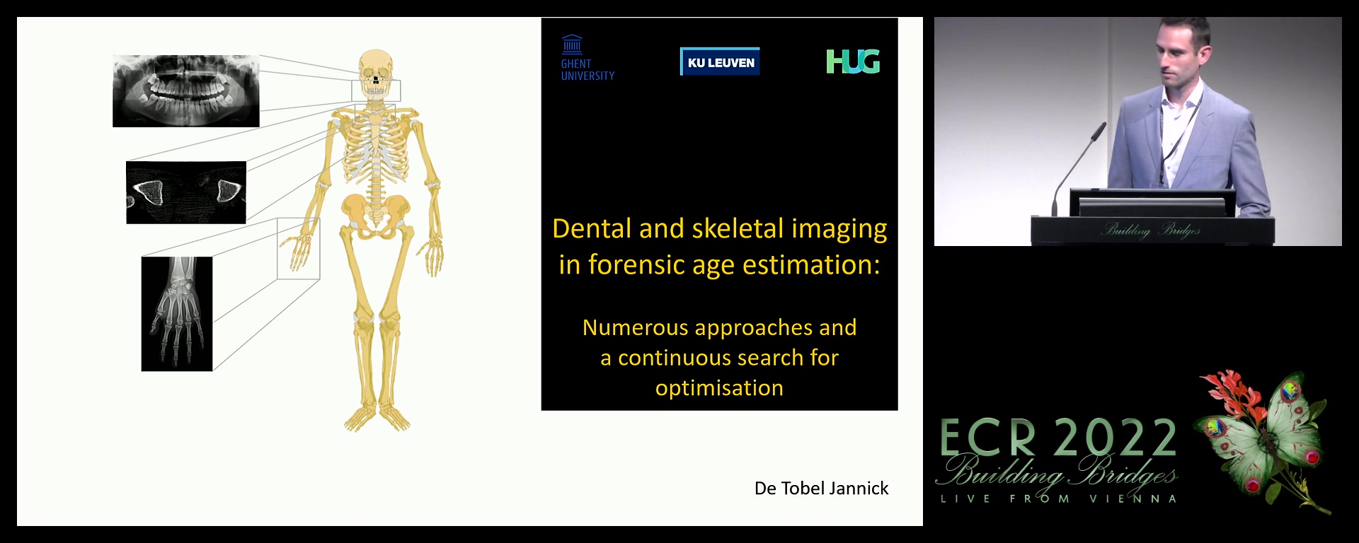 Dental and skeletal imaging in forensic age estimation - Jannick De Tobel, Leuven / BE