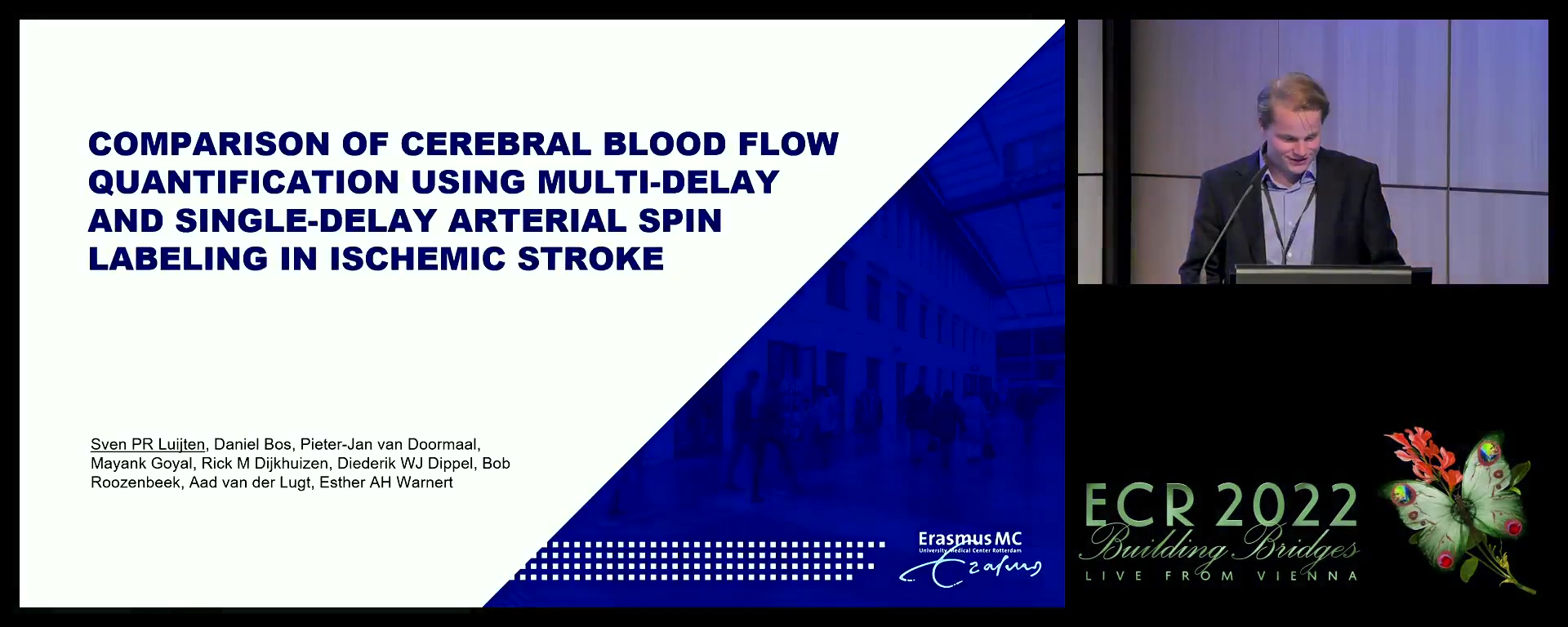 Comparison of cerebral blood flow quantification using multi- and single-delay arterial spin labelling in ischaemic stroke