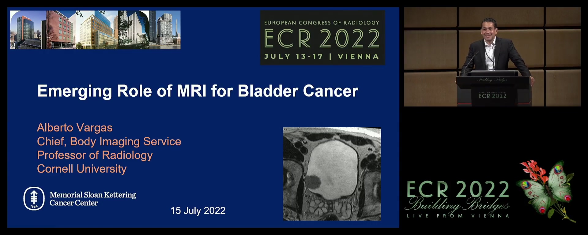 Emerging role of MRI