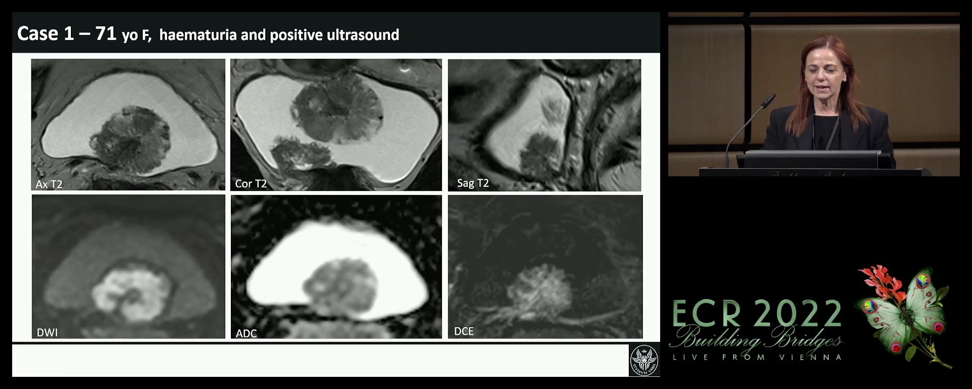 Multidisciplinary tumour board: case-based panel discussion