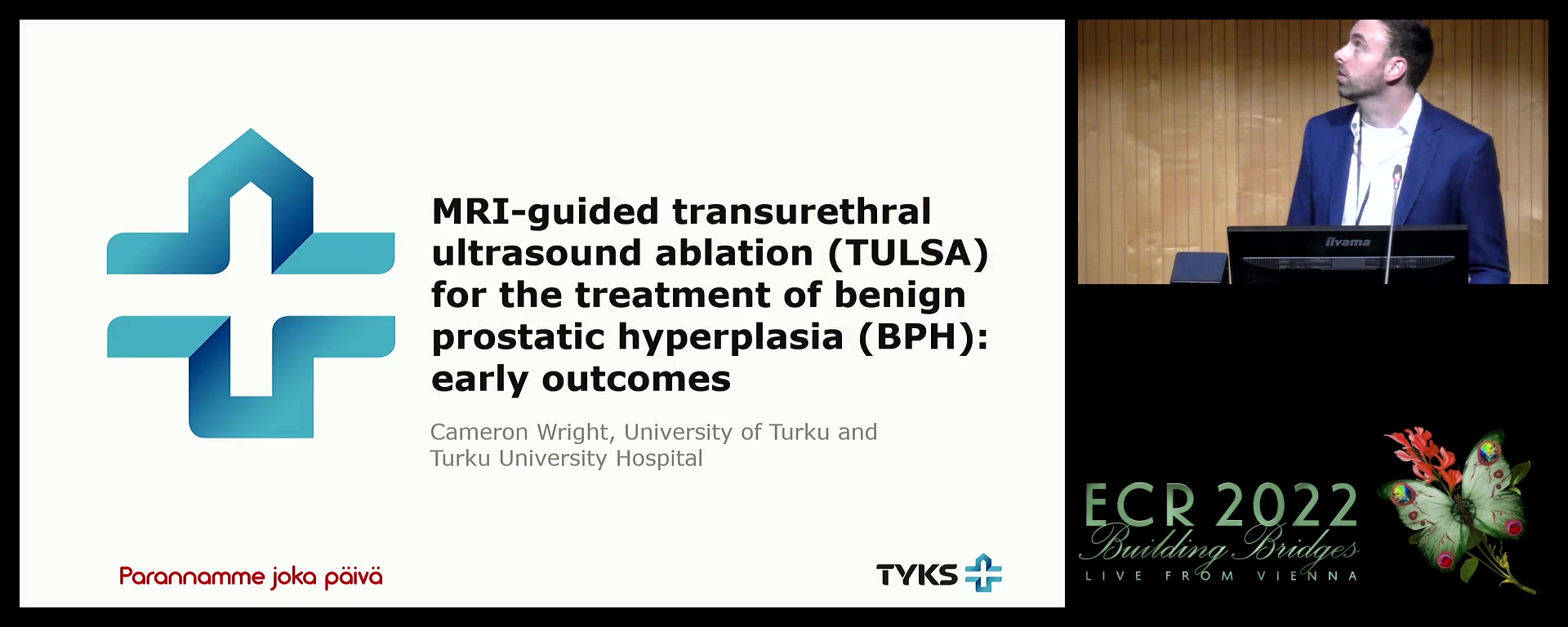 MRI-guided transurethral ultrasound ablation (TULSA) for the treatment of benign prostatic hyperplasia: early outcomes - Cameron Wright, Hamburg / DE