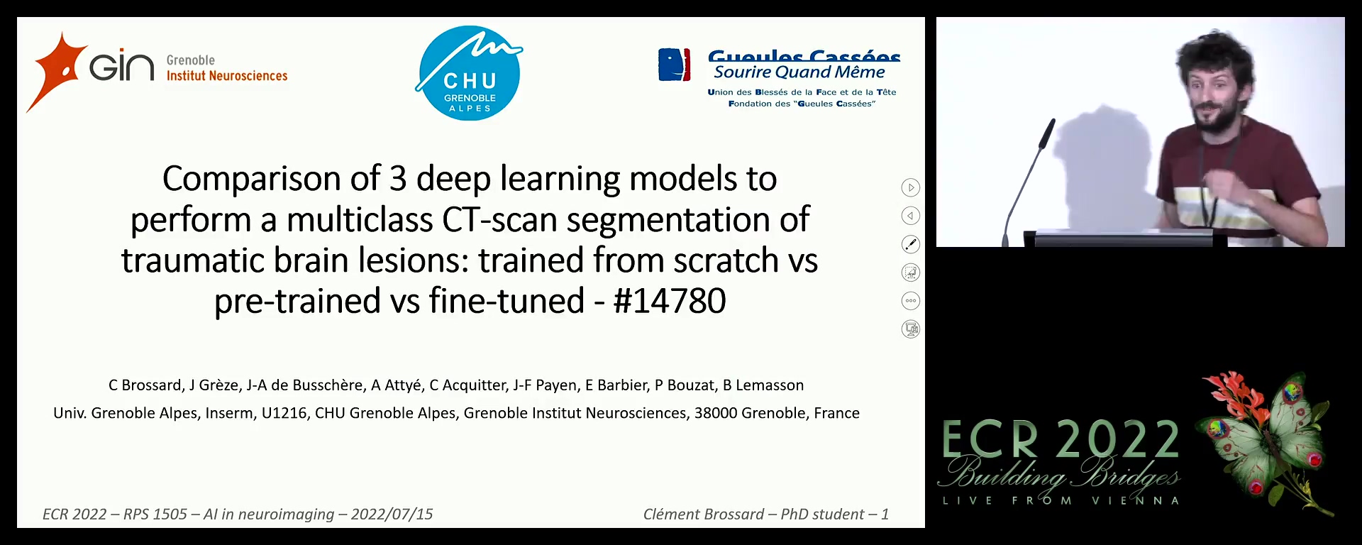 Comparison of 3 deep learning models to perform a multiclass CT-scan segmentation of traumatic brain lesions: trained from scratch vs pre-trained vs fine-tuned - Clément Brossard, Villeurbanne / FR