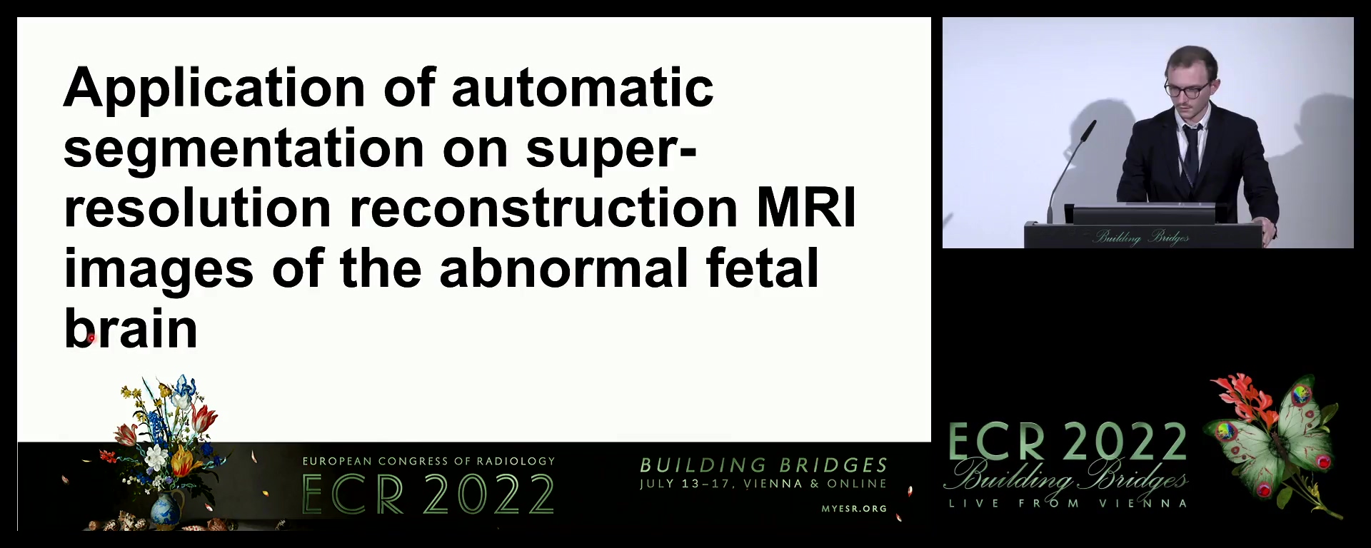 Application of automatic segmentation on super-resolution reconstruction MRI images of the abnormal fetal brain - Thomas Deprest, Aalst / BE