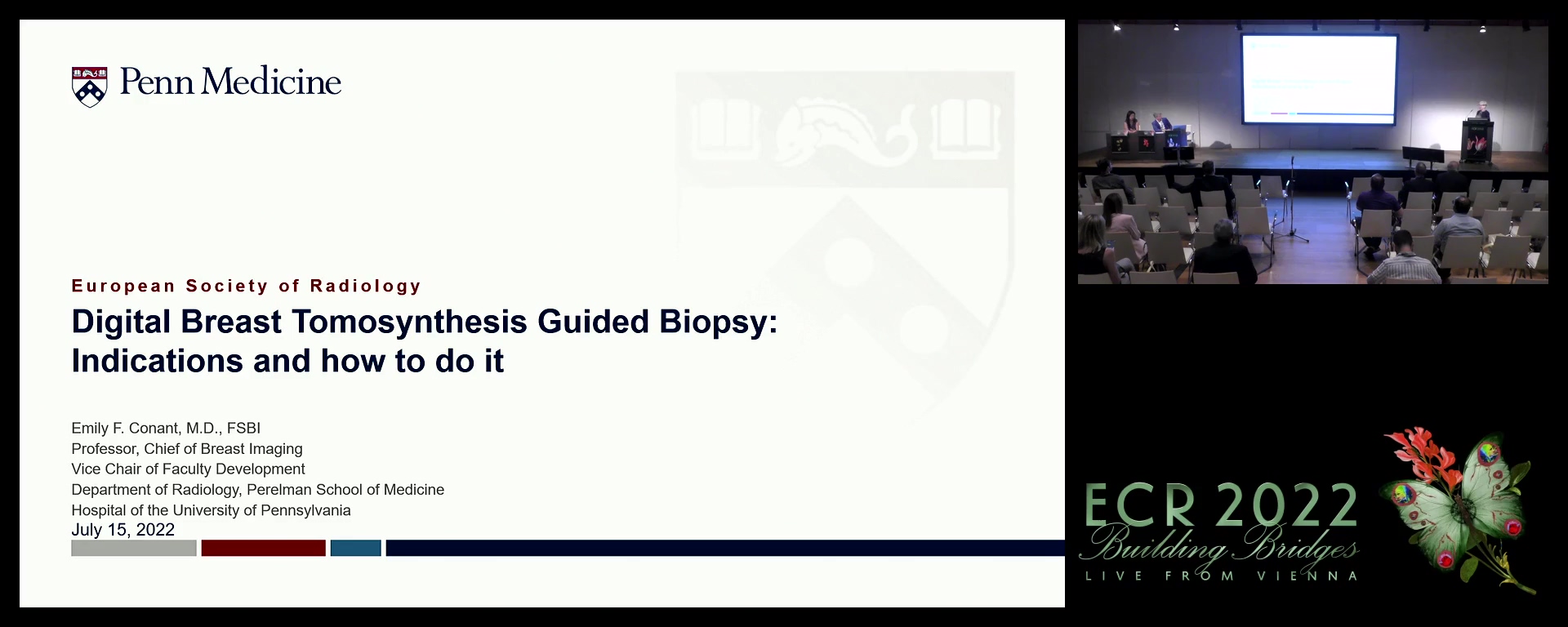 A. Digital breast tomosynthesis-guided biopsy: how to do it, indications