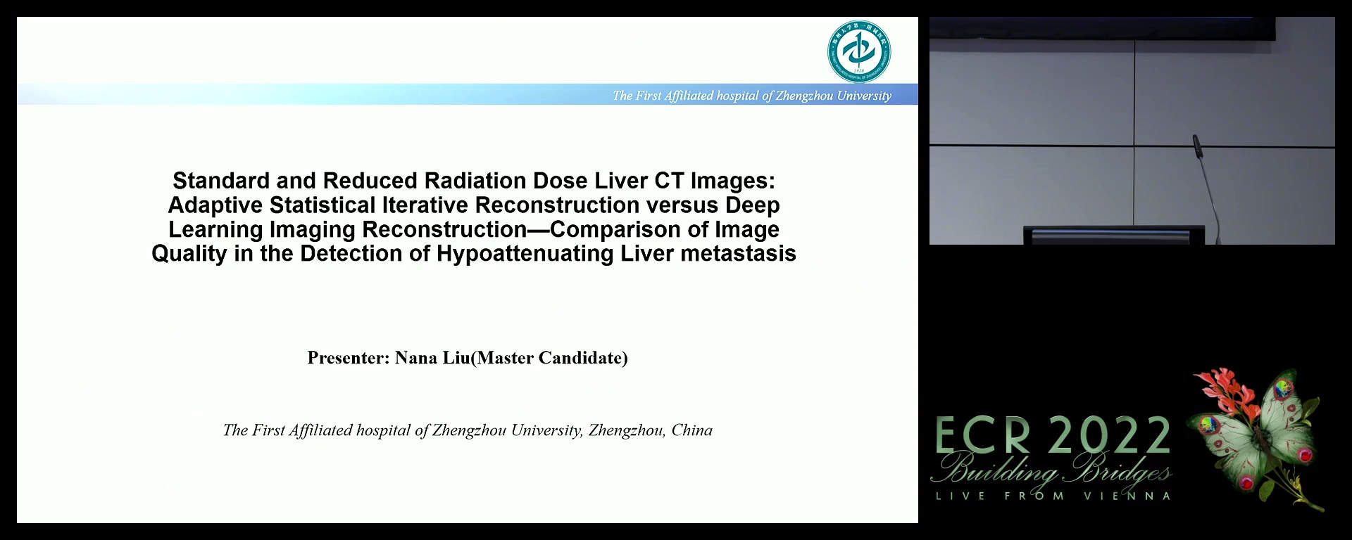 Comparison of iterative reconstruction and deep learning imaging reconstruction in detection of hypoattenuating liver metastasis - Nana Liu, zheng zhou / CN