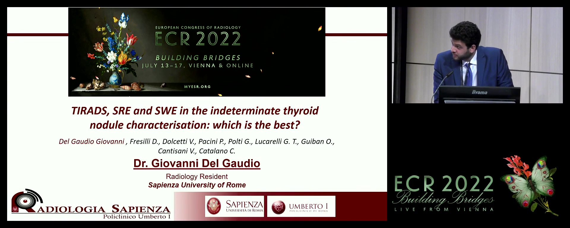 TIRADS, SRE and SWE in the indeterminate thyroid nodule characterisation: which is the best?