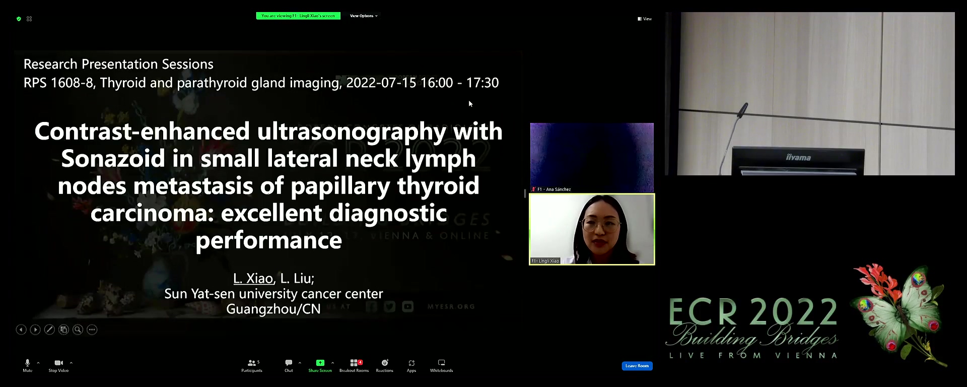 Contrast-enhanced ultrasonography with Sonazoid in small lateral neck lymph nodes metastasis of papillary thyroid carcinoma: excellent diagnostic performance