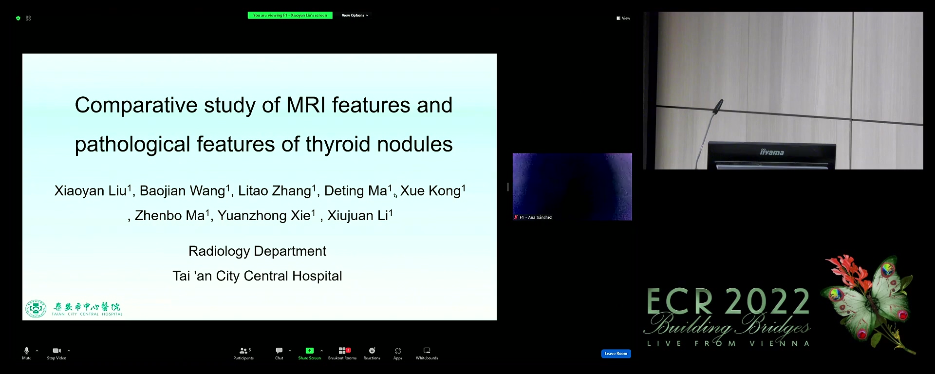 Comparative study of MRI features and pathological features of thyroid nodules