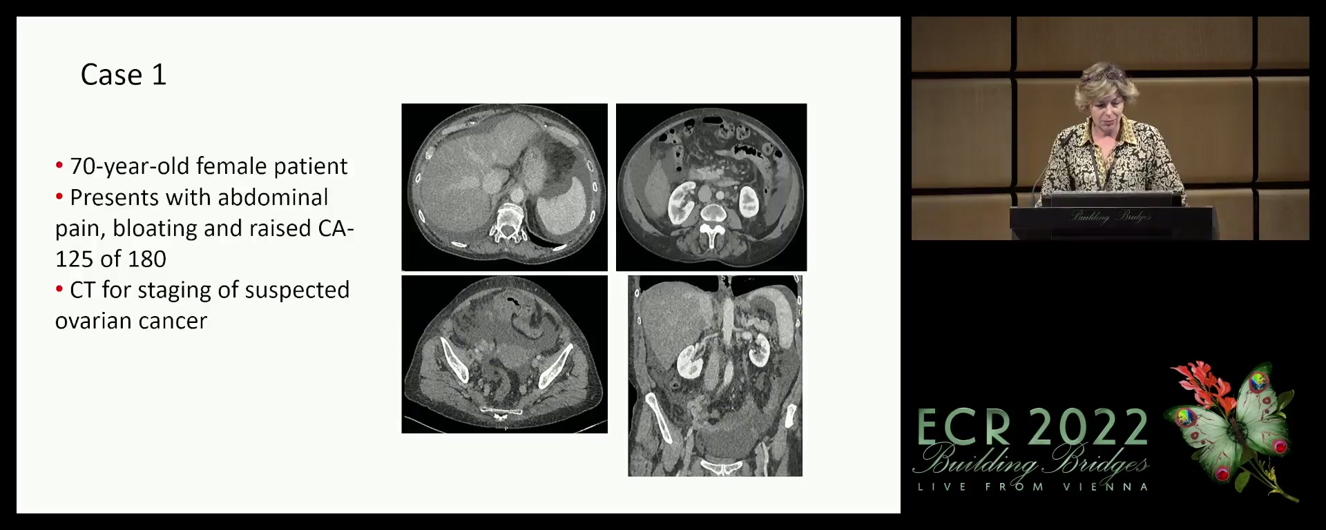 Multidisciplinary tumour board: case-based panel discussion