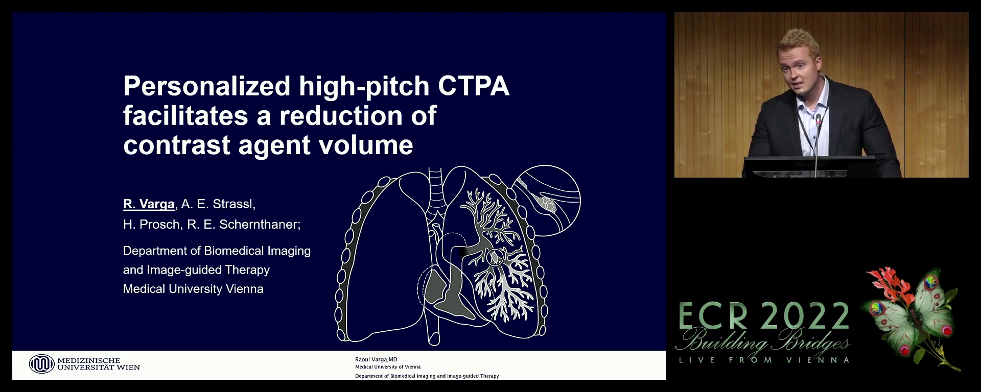 Personalised high-pitch CTPA facilitates a reduction of contrast agent volume - Raoul Varga, Wien / AT