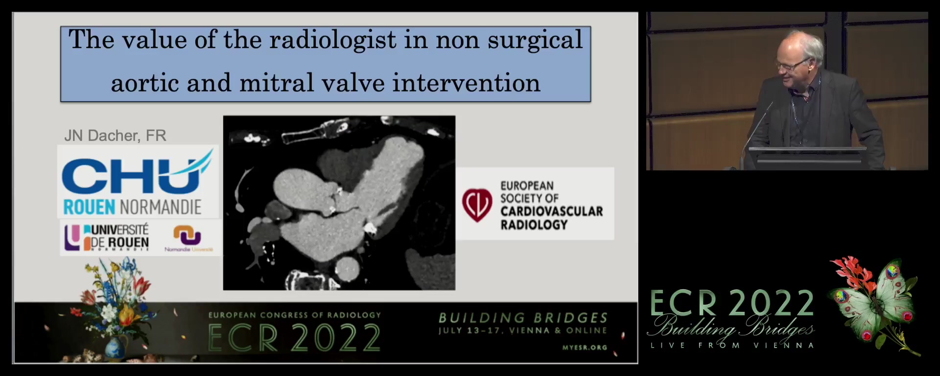The value of the radiologist in non-surgical aortic and mitral valve intervention