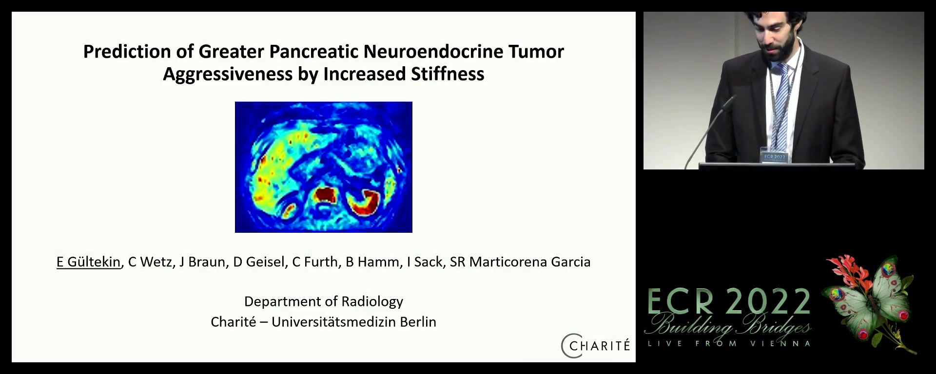 Prediction of greater pancreatic neuroendocrine tumour aggressiveness by increased stiffness
