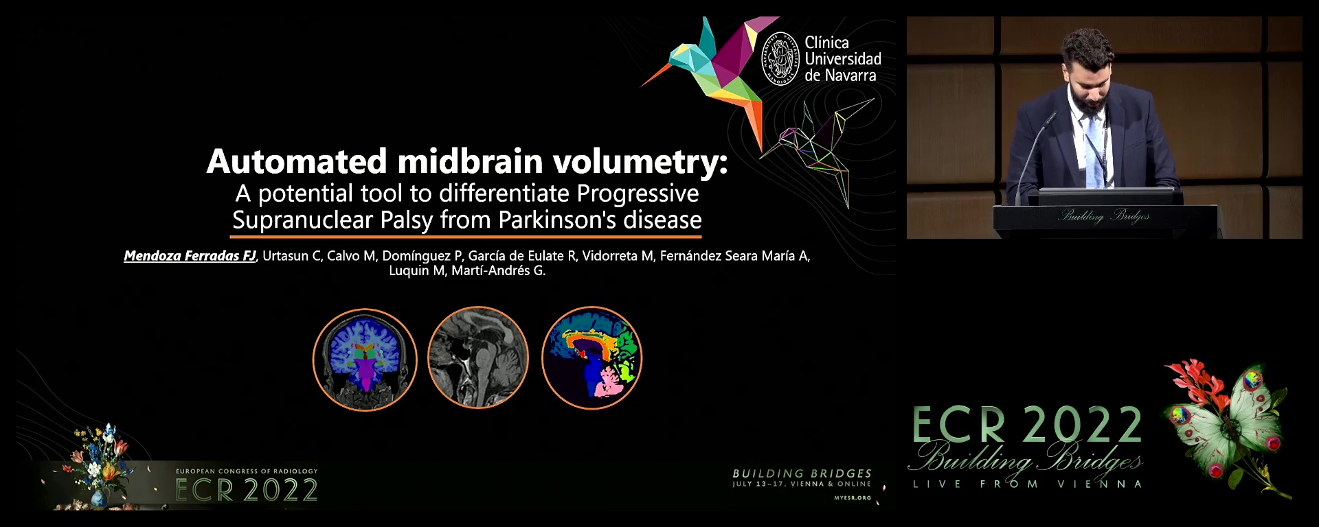 Automated midbrain volumetry: potential tool to differentiate progressive supranuclear palsy from Parkinson's disease