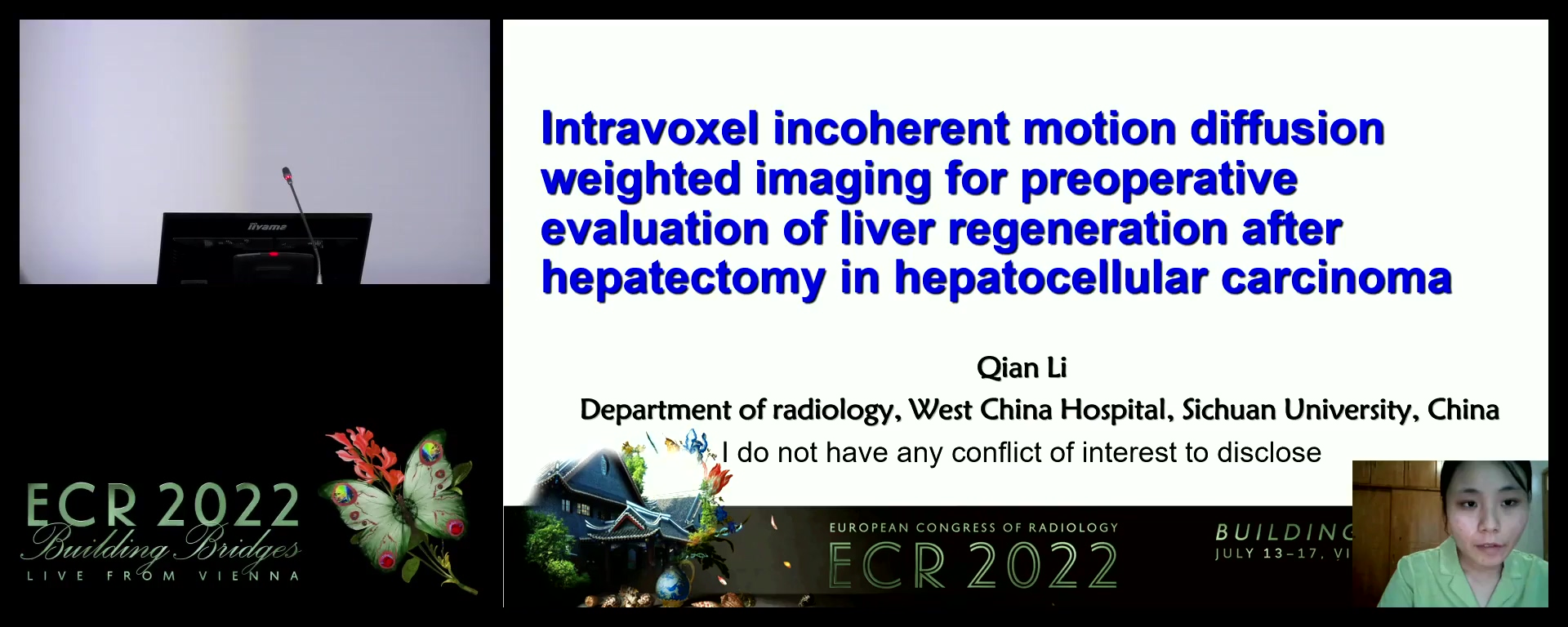 Value of intravoxel incoherent motion for preoperative evaluation of liver regeneration in hepatocellular carcinoma - Qian Li, Chengdu / CN