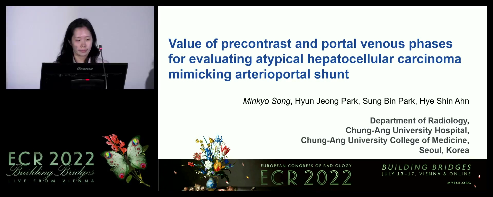 Value of precontrast and portal venous phases for evaluating atypical hepatocellular carcinoma mimicking arterioportal shunt - Minkyo Song, Seoul / KR
